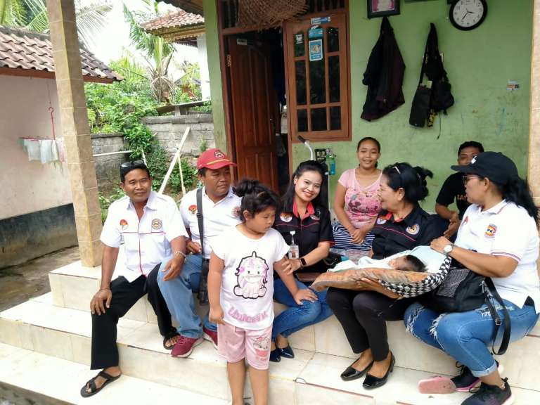 JPKP Bali Dampingi Bayi di Batuyang Tanpa Tempurung Kepala dan Stunting, Harapkan Ada Bantuan Pemerintah